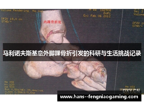 马利诺夫斯基意外脚踝骨折引发的科研与生活挑战记录 马利诺夫斯基意外脚踝骨折引发的科研与生活挑战记录